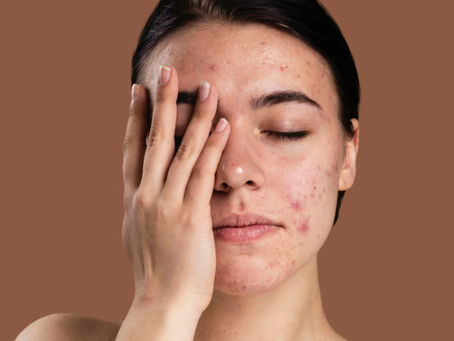 What are Toxins and Why We Should Avoid Them?